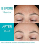 CeraVe Resurfacing Retinol Serum – For Clear & Even Skin