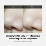 Medicube Zero Foam Cleanser | Pore-Tightening Daily Facial Cleanser for Sensitive Skin