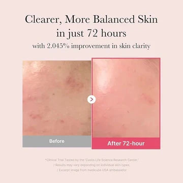 Medicube TXA Niacinamide 15 Serum – Brightening & Glow