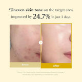 Medicube Kojic Acid Turmeric Night Wrapping Mask – 75ml | Brightening & Hydrating Overnight Treatment